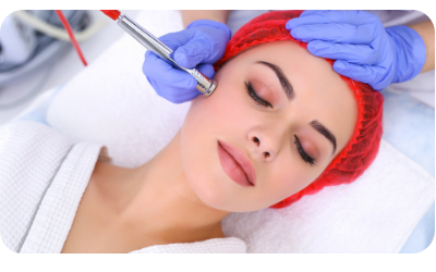 Imagem Peeling de Diamante